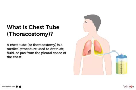 a shrmale tube